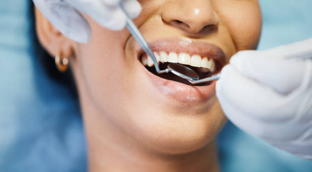 Best Emergency Dental Care for Broken or Chipped Teeth in Taunton, MA