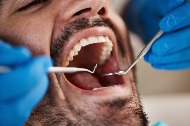 Professional Emergency Dentist in MA