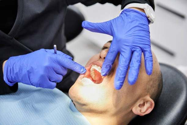 Best Emergency Tooth Extraction in Taunton, MA