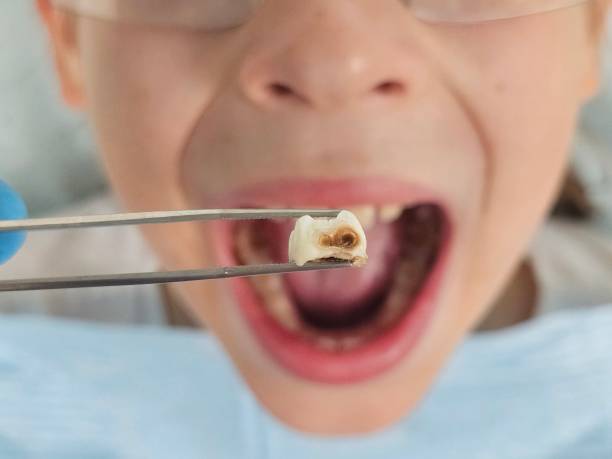 Best Pediatric Emergency Dentist in Taunton, MA